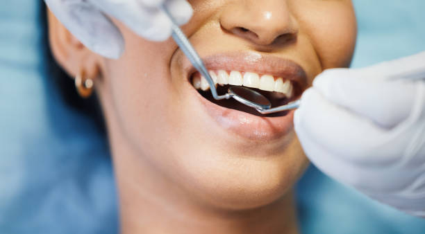 Best Emergency Dental Extractions in Pullman, WA